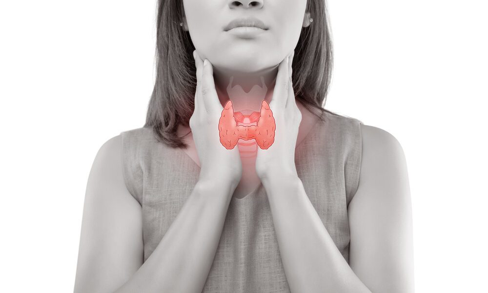 Imagem da região da tireoide de uma mulher com a sinalização vermelha no nódulo.