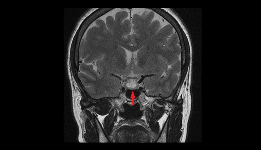 Imagem ilustrando um raio-x de cérebro.,