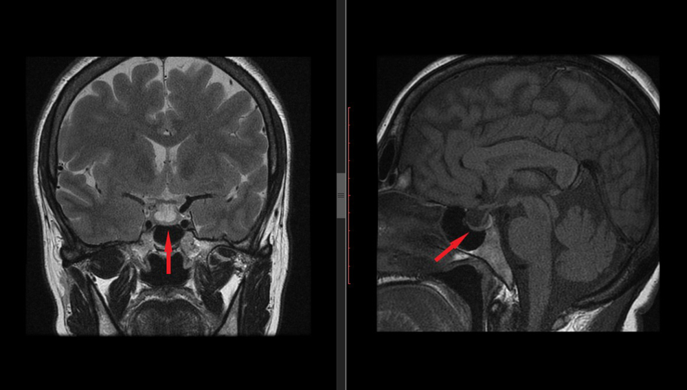 Imagem de um raio-x da cabeça.