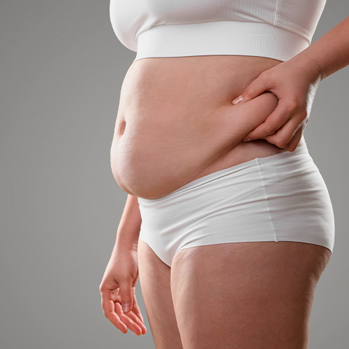 Mulher em roupa branca segurando a pele da barriga, destacando gordura abdominal.