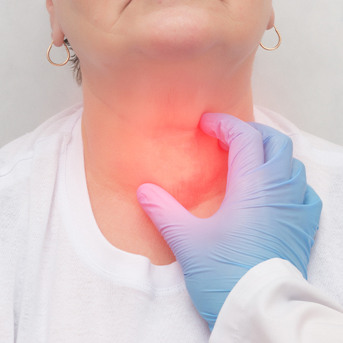Médico palpando a região da tireoide no pescoço de uma paciente, com área avermelhada destacando possível inflamação.